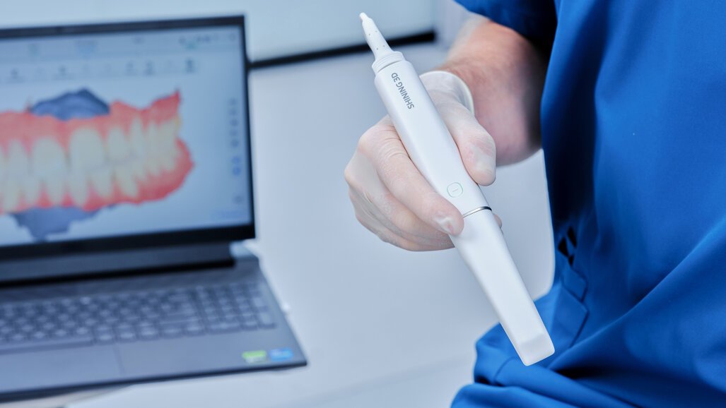 Gloved hands holding a Shining 3D intraoral scanner with a colour 3D dental model displayed on the laptop behind